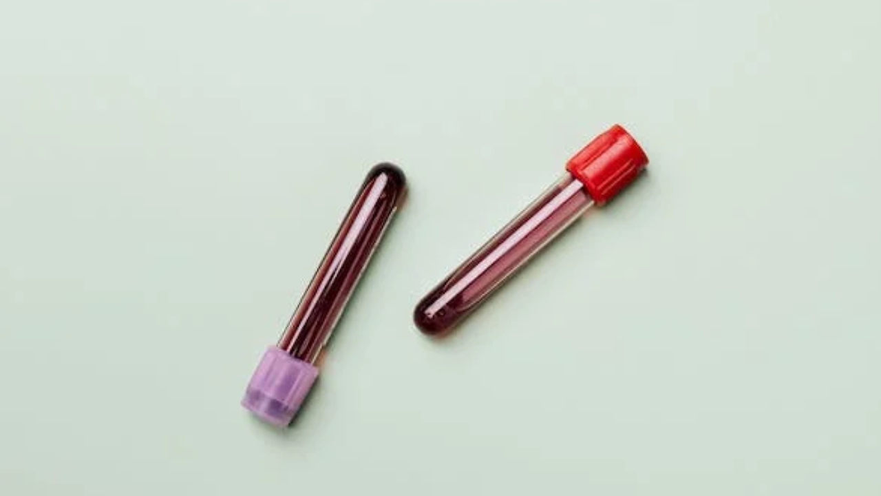 12 Important Blood Tests One Should Get Done Annually | Zoom TV