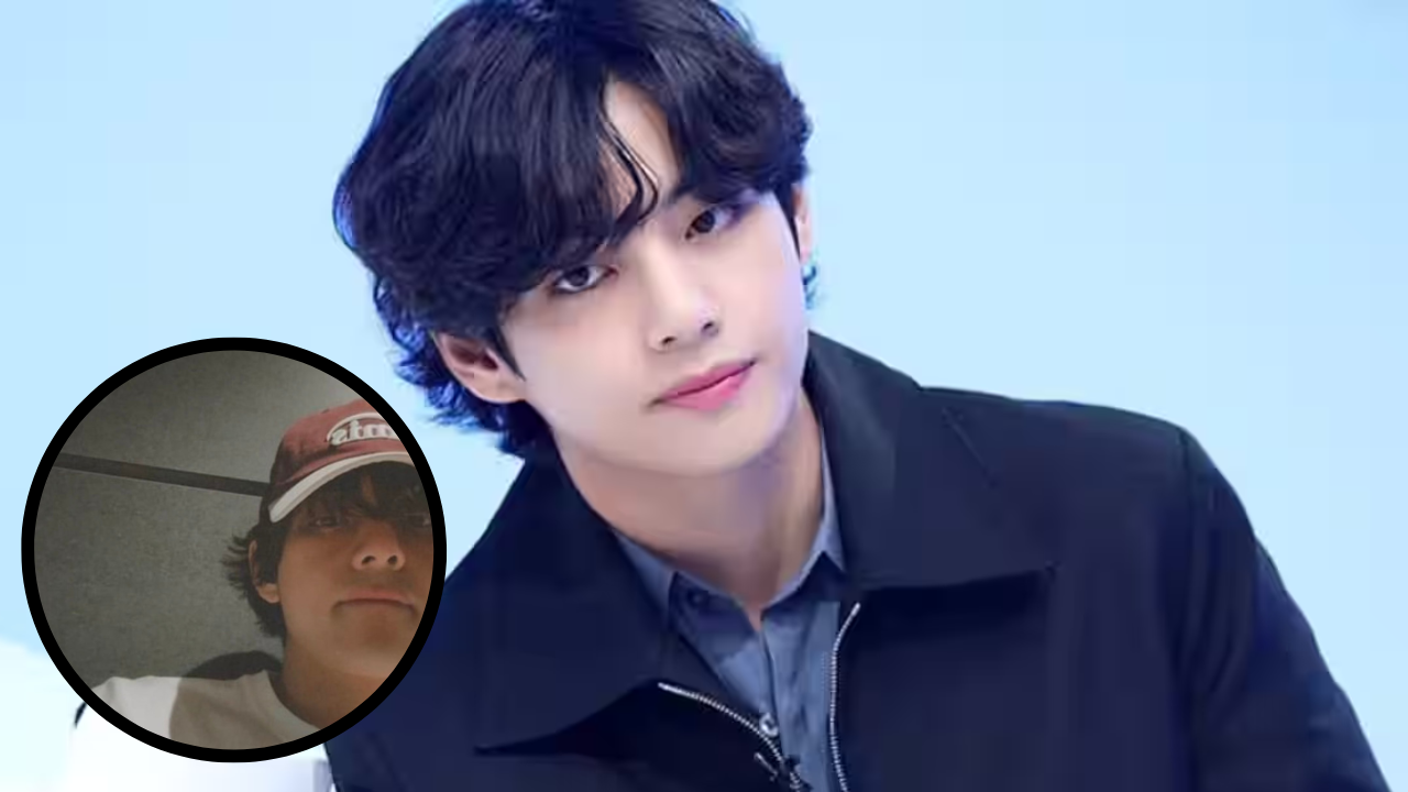 BTS' V sports a bruise under his eye