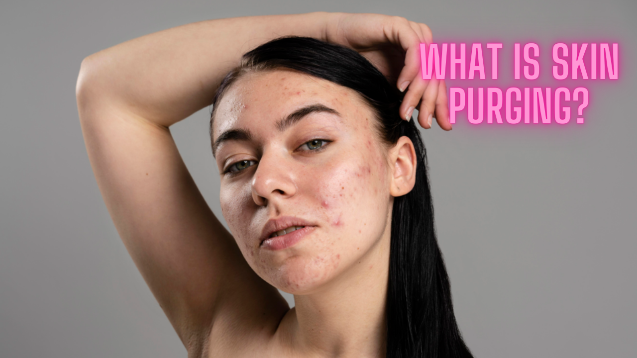 All you need to know about Skin Purging. Pic Credit: Freepik