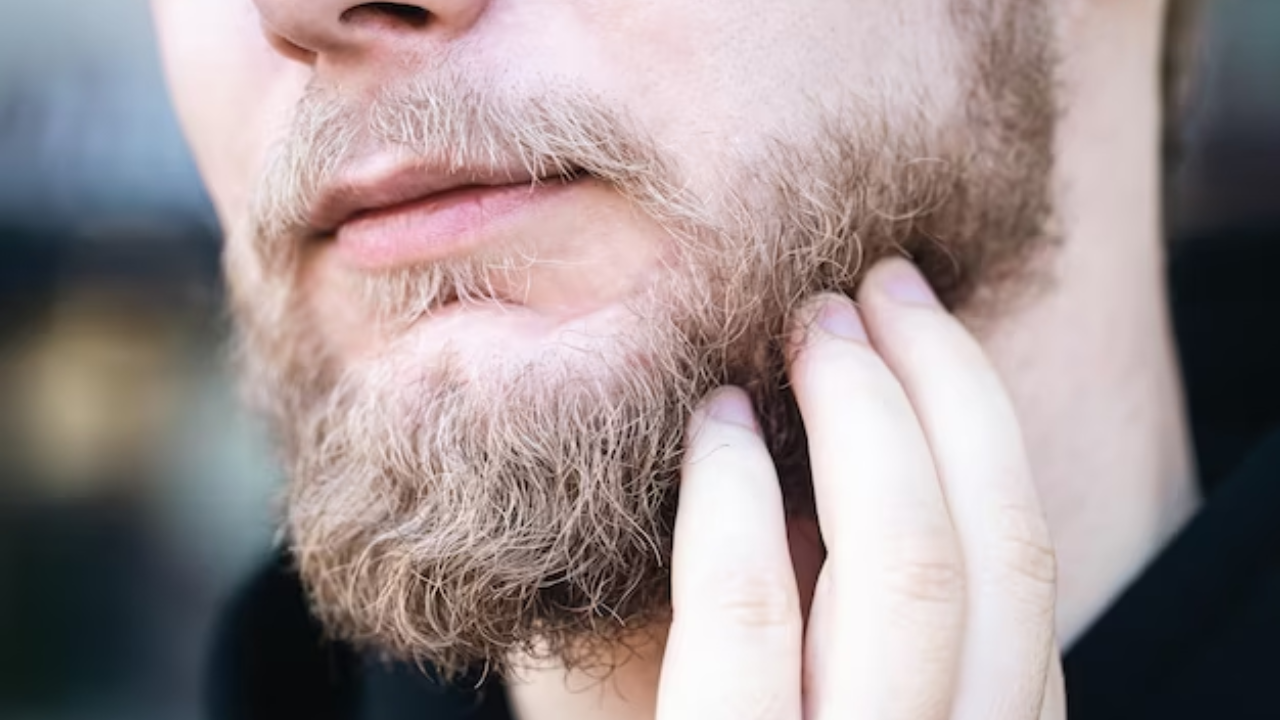 Beard Pimples Treatment