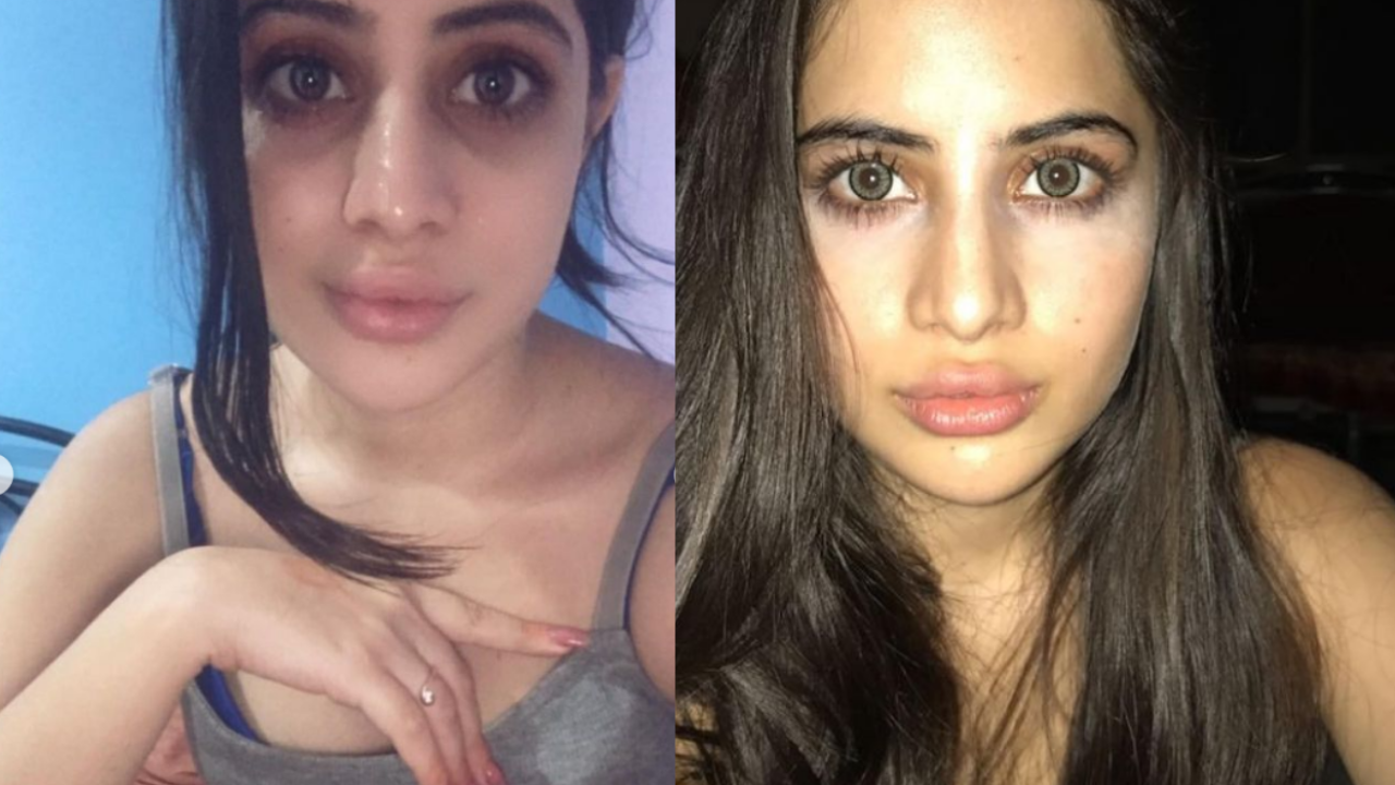 Urfi Javed Lip Surgery