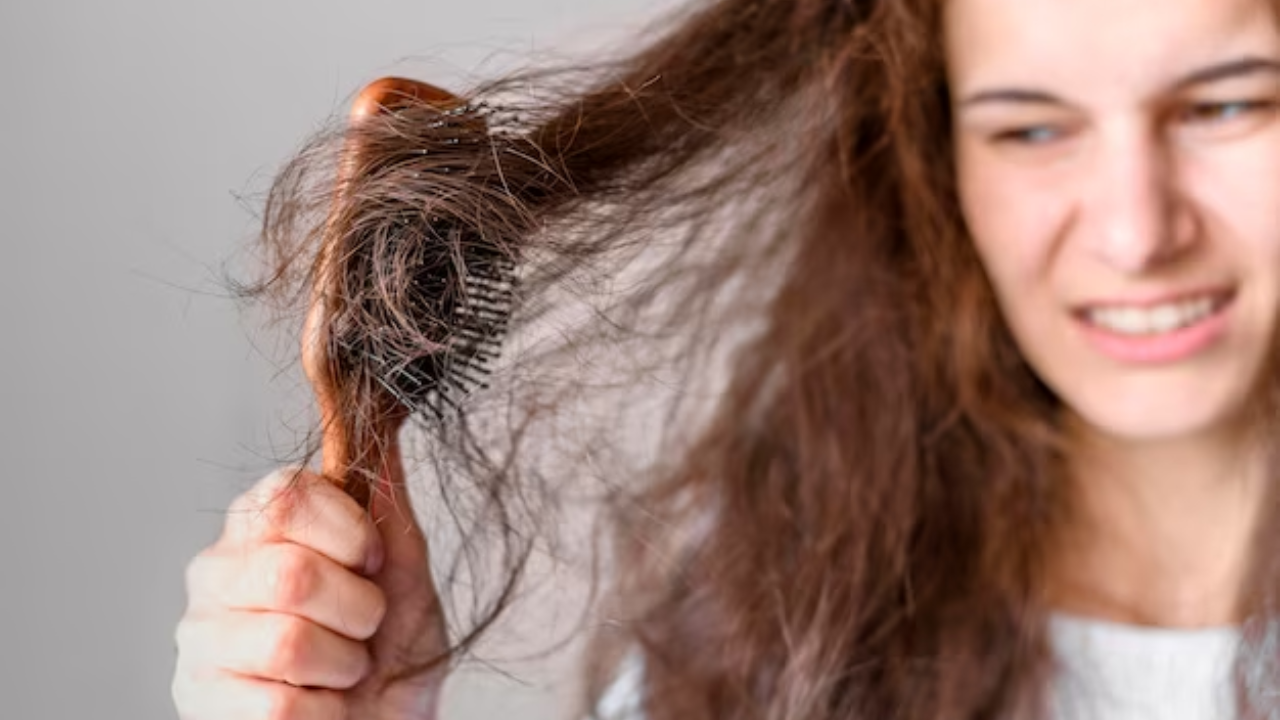 8 Food Items to Help Prevent Hair Loss