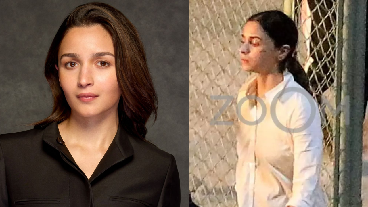 Alia Bhatt's EXCLUSIVE Pics Ft Actress With Injured Cheek, Bandage From Jigra Shoot