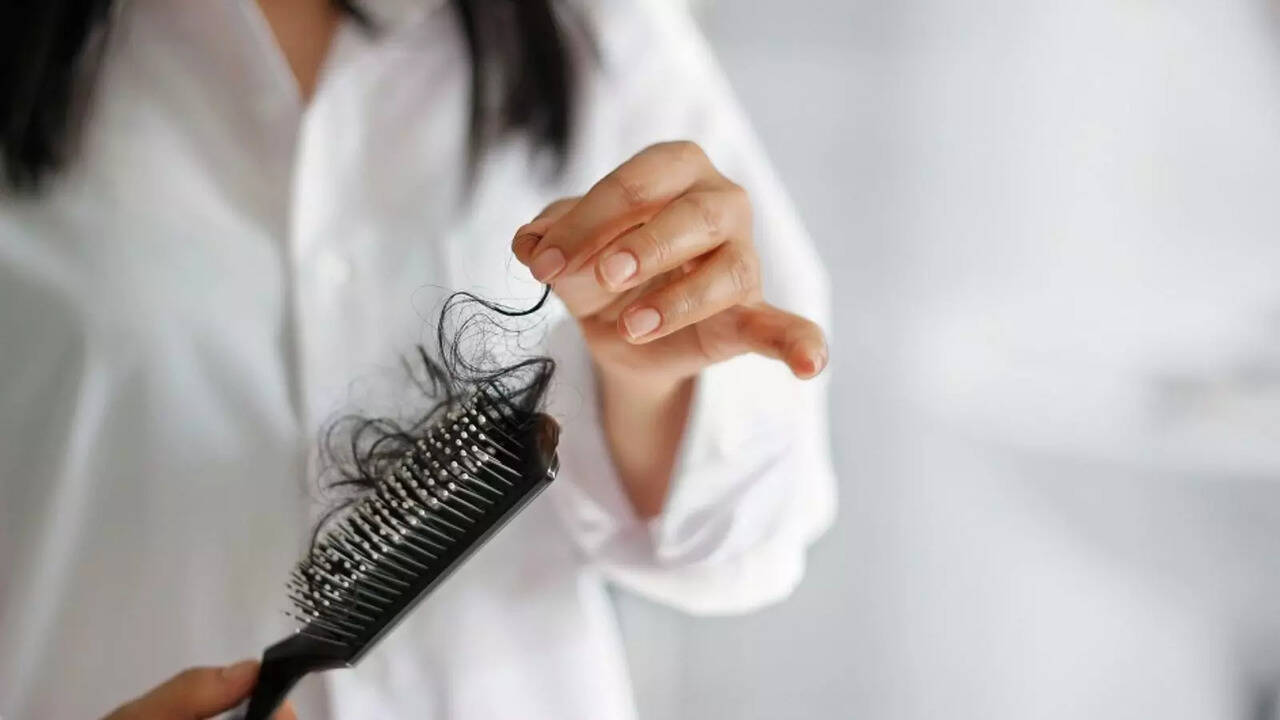 HairLoss