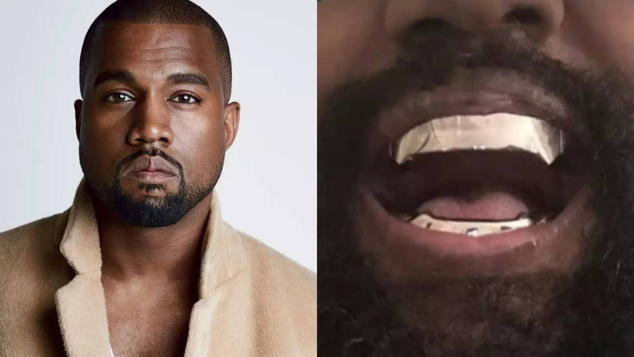 Kanye West Replaced His Natural Teeth With James Bond-Inspired Titanium Dentures And Its Cost Will Make Your Jaws Drop