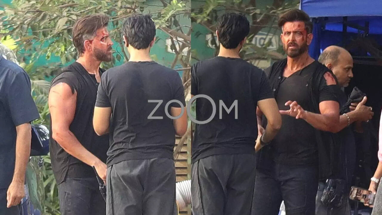 Hrithik Roshan SPOTTED All Bruised On Sets Of War 2 - Exclusive Pics