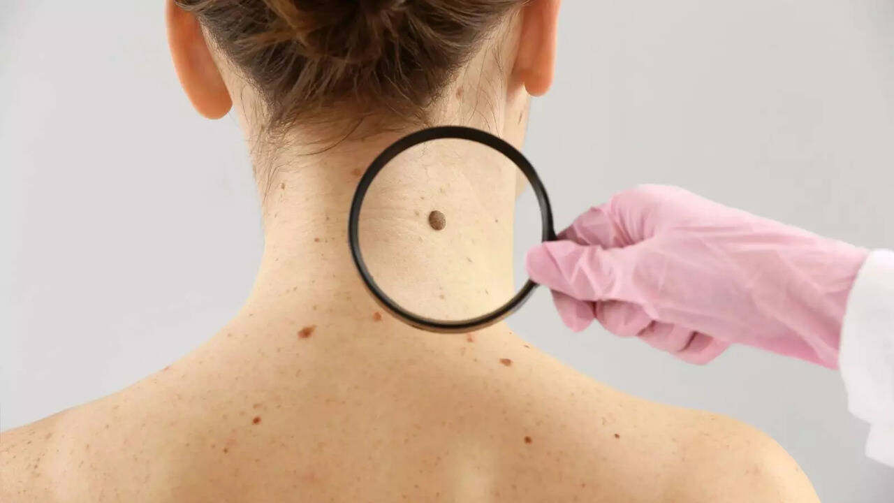 Understanding Skin Screening: What To Look For And How To Identify Red Flags