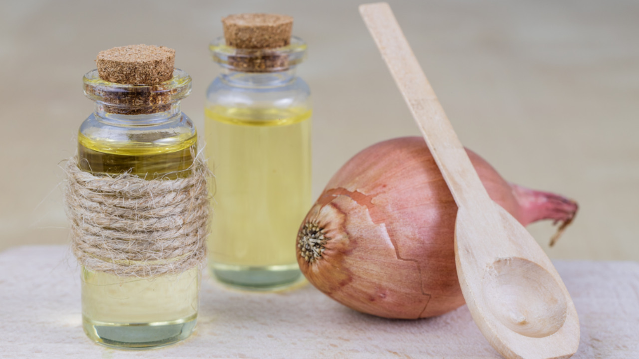 Onion juice recipe for hair loss. Pic Credit: iStock