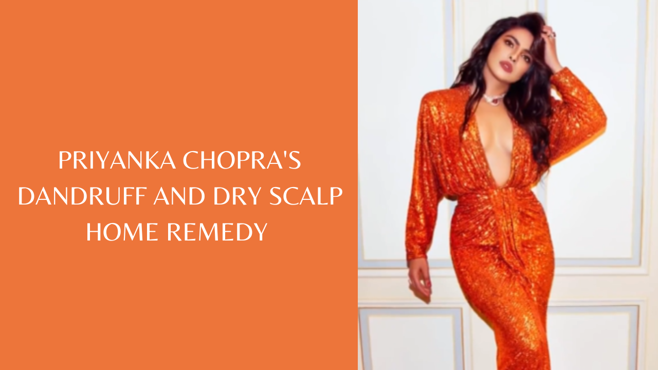 Priyanka Chopra's home remedy for dandruff and dry scalp. Pic Credit: Instagram