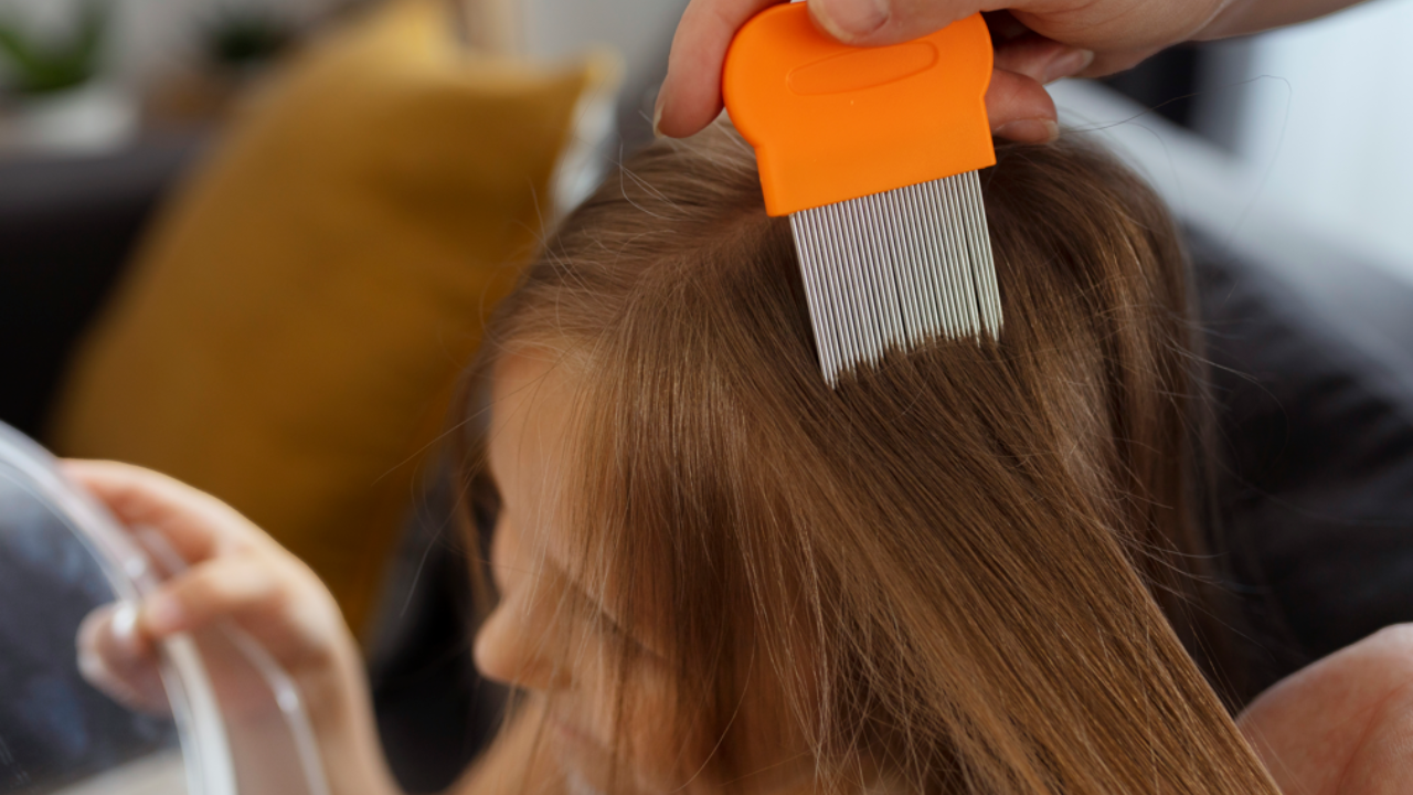 Lice removal home remedies. Pic Credit: Freepik